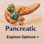 Pancreatic cancer watercolor illustration