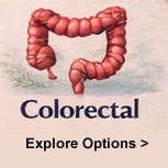 Colorectal cancer watercolor illustration
