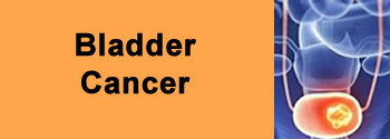 Blader Cancer